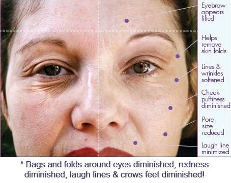 Συσκευή Αναζωογόνησης και Καθαρισμού του Δέρματος Dermawand - Εικόνα 3