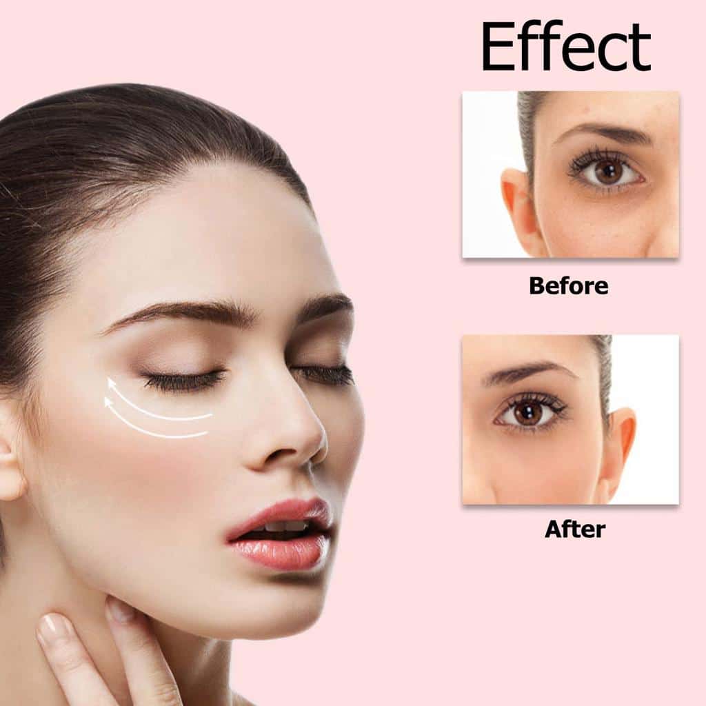 Συσκευή Ενυδάτωσης, Καθαρισμού Προσώπου και Ακμής Αρνητικών Ιόντων 4W - Εικόνα 3